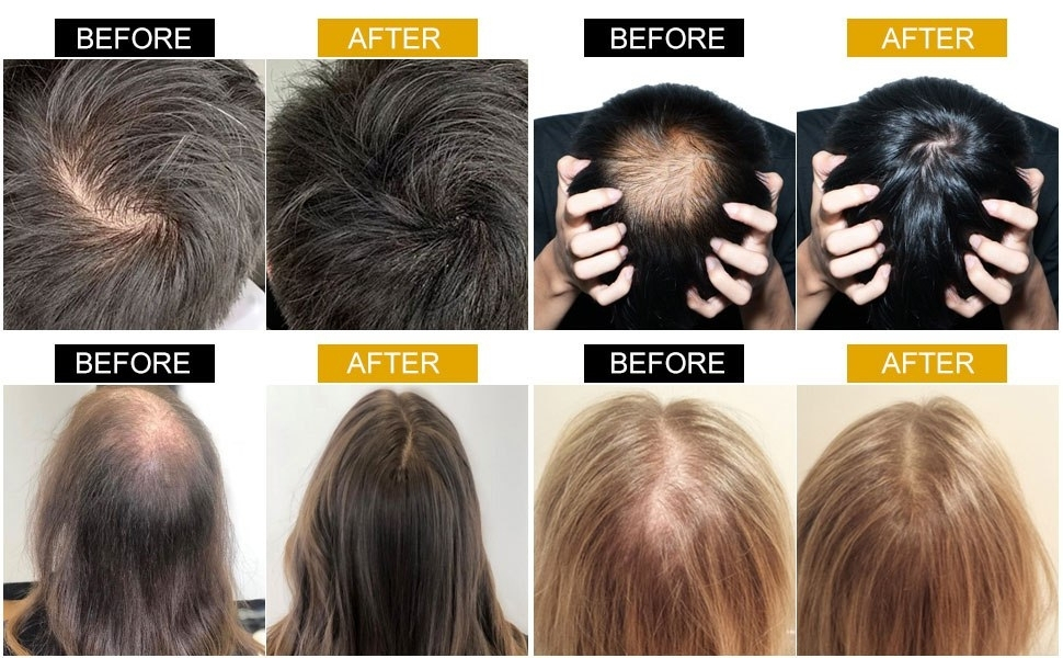 RootRevive Hair Growth Oil