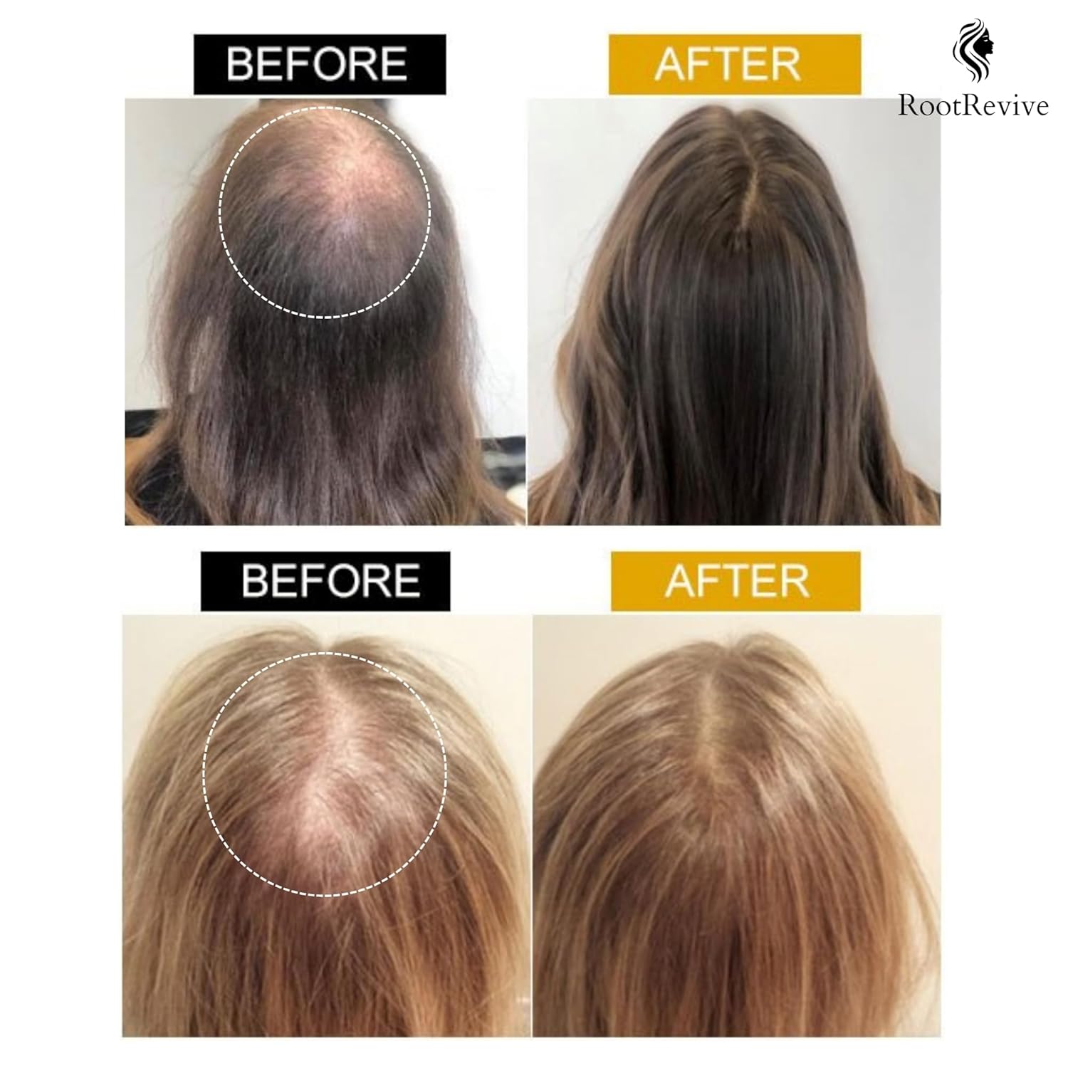Hair Oil Bottle